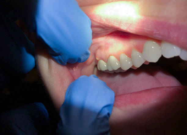 Best Emergency Root Canal Therapy in Altus, OK